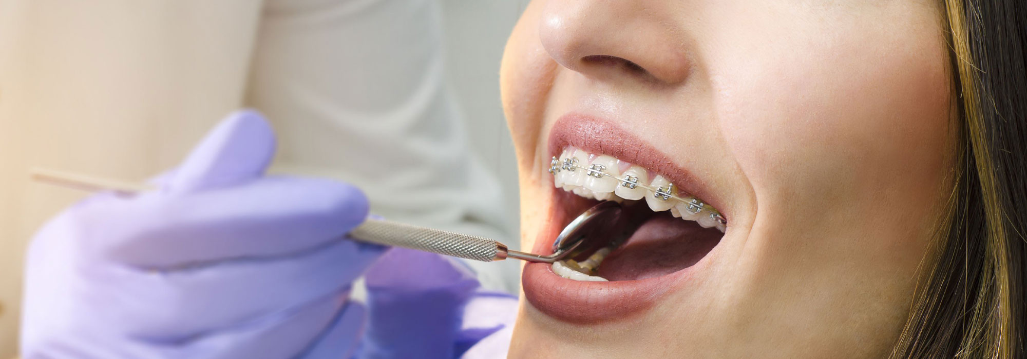 ¿Duele el tratamiento de ortodoncia?